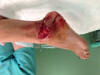 contusion1.JPG (289680 bytes)